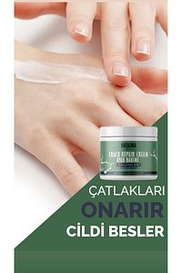 Ayak Tırnak Mantar El Bakım Topuk Çatlağı Beyazlatıcı Etkili Krem 150 ml ürün fotoğrafı