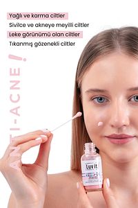 Sivilce ve Akne Karşıtı Losyon 30ml – Salisilik Asit Içeren Kurutucu ürün fotoğrafı