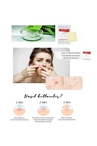 Acne Pimple Master Patch Acne 36 Patch & Akne Ve Sivilce Bandı 01 ürün fotoğrafı