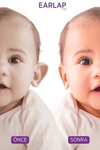 Earlap Baby Kepçe Kulak Bandı ürün fotoğrafı