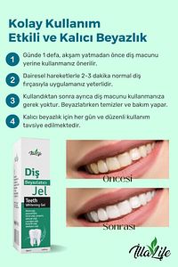 Whitening Expert Hızlı Etkili Diş Beyazlatıcı Jel Yeni Nesil Diş Parlatıcı Ve Temizleme Jeli 50 ml ürün fotoğrafı