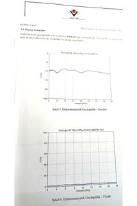 Radyasyonu %99 Önleyici Tübitak Onaylı Sticker Siz Ve Aileniz Için Cep Telefonu Emf Kalkanı ürün fotoğrafı