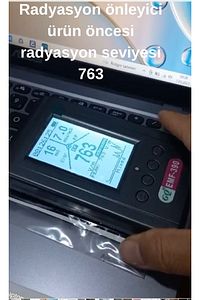 Radyasyonu %99 Önleyici Tübitak Onaylı Sticker Siz Ve Aileniz Için Cep Telefonu Emf Kalkanı ürün fotoğrafı