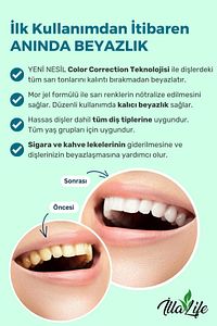 Whitening Expert Hızlı Etkili Diş Beyazlatıcı Jel Yeni Nesil Diş Parlatıcı Ve Temizleme Jeli 50 ml ürün fotoğrafı