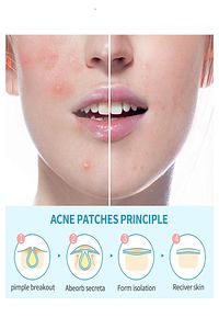 36 Adet Ve Bandı - Pimple Patch Acne Patch ürün fotoğrafı