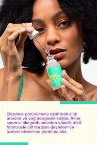 Hi Girls Bye Pores – Gözenek Karşıtı Serum ürün fotoğrafı
