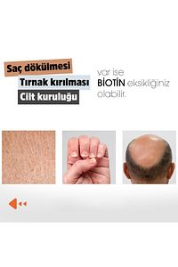 Biotin (ÇİNKO ÇÖREKOTU CİVAN PERÇEMİ AT KUYRUĞU ISIRGAN EKSTRESİ) 60 Kapsül ürün fotoğrafı