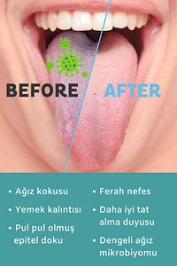 Paslanmaz Çelik Dil Temizleyici / Dil Sıyırıcı ürün fotoğrafı
