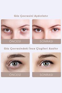Yaşlanma ve Kırışıklık Karşıtı Titreşimli Elektrik Masajlı Göz Altı Halka ve Morluk Bakım Kremi 20ml ürün fotoğrafı