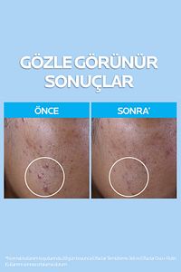 Effaclar Temizleme Jeli 400ml Yağlı Ve Akneye Eğilim Gösteren Ciltler ürün fotoğrafı