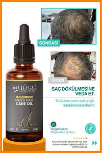 Erkek Saç Bakım Yağı - Dökülme Karşıtı, Saç Çıkarıcı & Besleyici Etki, E & A Vitaminli 50 ml ürün fotoğrafı