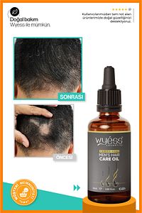 Erkek Saç Bakım Yağı - Dökülme Karşıtı, Saç Çıkarıcı & Besleyici Etki, E & A Vitaminli 50 ml ürün fotoğrafı