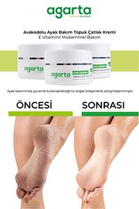 Ayak ve Topuk Çatlak Bakım Kremi 100 Ml ürün fotoğrafı