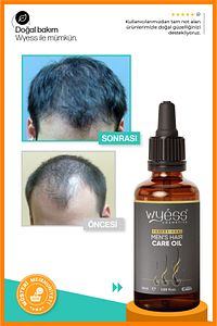 Erkek Saç Bakım Yağı - Dökülme Karşıtı, Saç Çıkarıcı & Besleyici Etki, E & A Vitaminli 50 ml ürün fotoğrafı