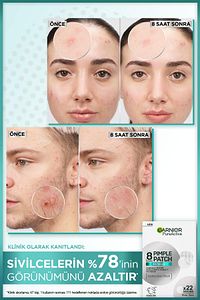 Pimple Patch 22'li Sivilce Bandı / Hidrokolloid Bant / Akne Karşıtı 22li Bant ürün fotoğrafı