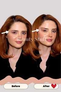 Bej Lastıklı Yüz & Göz Germe Bantları (20'Lİ PAKET) ürün fotoğrafı