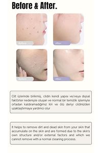 Soyucu Peeling Jel Krem Arındırıcı Sıkılaştırıcı Aydınlatıcı Yenileyici Siyah Nokta Yüz Temizleme ürün fotoğrafı