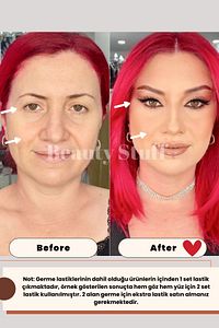 Bej Lastıklı Yüz & Göz Germe Bantları (20'Lİ PAKET) ürün fotoğrafı