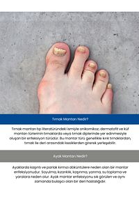 Ayak Ve Tırnak Bakım Spreyi ürün fotoğrafı