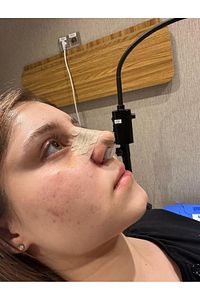 Burun Deligi Sekillendirici No (0)(6)nostril Retainer ürün fotoğrafı