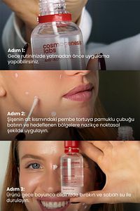 Acne Önleyici Kurutucu Losyon 30ml – Yatıştırıcı Siyah Nokta Azaltıcı Vegan (%5 KALAMİN - YEŞİL ÇAY) ürün fotoğrafı