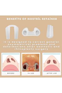 Burun Deligi Sekillendirici No (0)(6)nostril Retainer ürün fotoğrafı