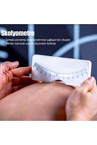 Skolyometre Skolyoz Ölçüm Cetveli ürün fotoğrafı