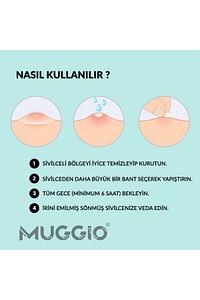 Ve Akne Söndürücü Bant 36'lı (KORE FORMÜLLÜ) ürün fotoğrafı