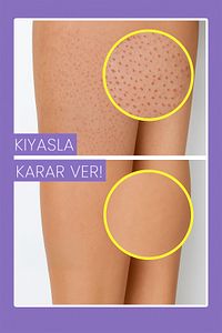 Epilasyon Sonrası Tüy Azaltıcı & Nemlendirici Süt | Pürüzsüz Cilt & Kalıcı Etki | 50ml ürün fotoğrafı
