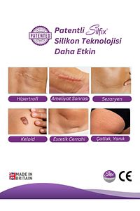 Siltape Soft Silikon Bant - Yanık Sezaryen Dikiş Izi Keloid Ameliyat Izi Giderici 2cmx3mt ürün fotoğrafı