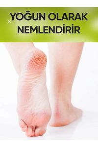 Ayak, Topuk, Çatlak, Mantar, Koku, Ve Diyabetik Yaralar Için Nemlendirici Bakim Kremi ürün fotoğrafı