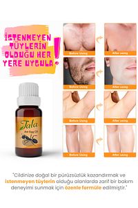 Karınca Yumurtası Yağı Tüy Azaltıcı Tüy İnceltici Tüy Dökücü 20 Ml ürün fotoğrafı