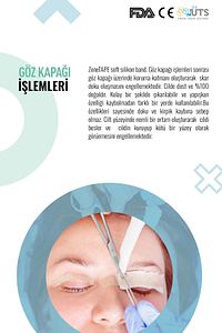 Soft Silikon Bant - 2cmx3mt- Estetik-skar-keloid-sezaryen-dikiş-karın/kol/bacak Germe-ben Aldırma ürün fotoğrafı