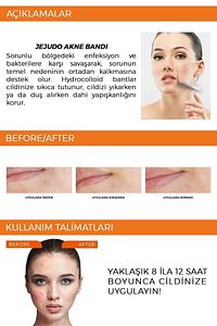 Ceuticals Original Pimple Patch 36 Patch - Akne Ve Sivilce Bandı ürün fotoğrafı
