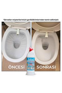 Solixel Tualet Taş Temizleyici 1 Adet ürün fotoğrafı