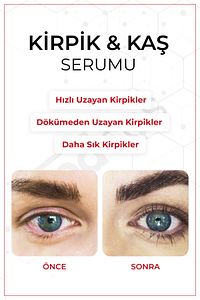 Kaş & Kirpik Güçlendirici Biotin+Peptit+Bitkisel Yağ Kompleksi Uzatma,Gürleştirme ve Dökülme Karşıtı ürün fotoğrafı