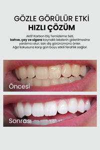 Aktif Karbonlu Diş Beyazlatıcı Toz | Sigara, Çay & Kahve Lekelerine Karşı | Doğal Formül | 50g ürün fotoğrafı