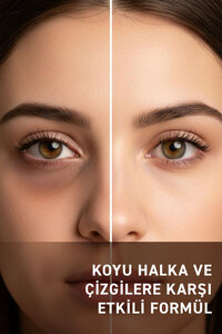 Herba Derm Torba Ve Morluklara Karşı Göz Altı Kremi 15 ml ürün fotoğrafı