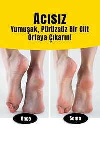 Ayak Tabanı Bakım Törpüsü Topuk Nasır Temizleme Rendesi Pedegg ürün fotoğrafı