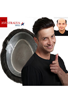 SACPROTEZİM Protez Saç Avustralya 8x10 1b/2 Ince Telli Her Yöne Taranabilen Alt Yapı %100 Insan Saçı