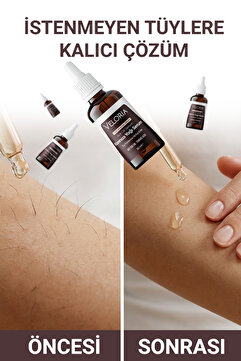 Veloria Cosmetics Karınca Yumurtası Yağlı Tüy Azaltıcı Tüy Dökme, Mucizevi Serum 30ml