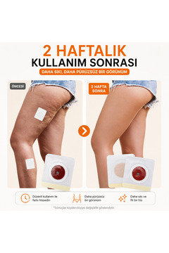 Dihamer Basen Bant Azaltma Patch Bacak Sıkılaştırıcı Bant 6’lı Set