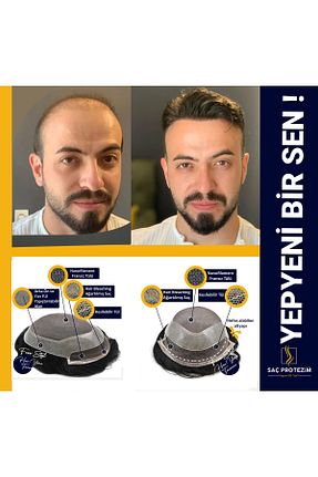 کلاه گیس آبی مردانه SACPROTEZİM - کد 841141833