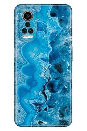 کاور و قاب سفید General Mobile - کد 261866776