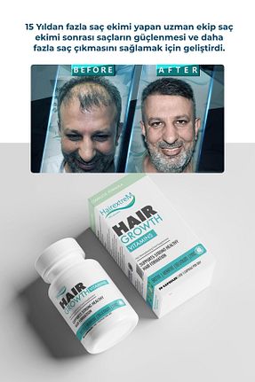 ویتامین مو hairextrem - کد 311504672