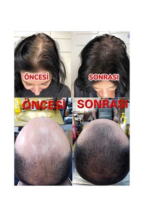 ست مراقبت مو mavi serum - کد 348088572