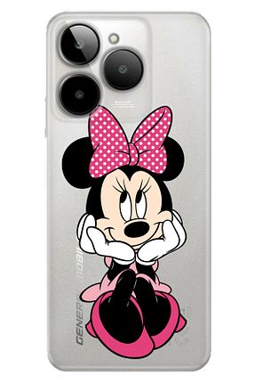 کاور و قاب زرد General Mobile - کد 856518218