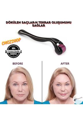 درمارولر مشکی 500-999 CNGZSHOP - کد 827935206