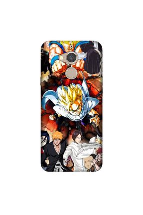 کاور و قاب مشکی General Mobile - کد 286029993