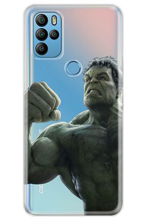 کاور و قاب رنگی General Mobile - کد 286022199